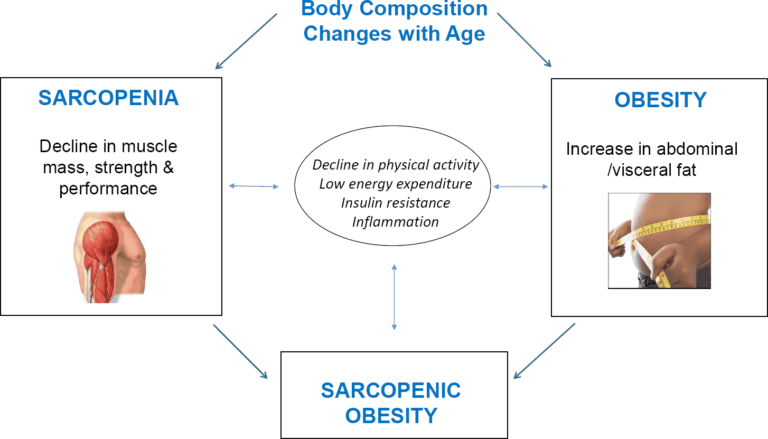 Sarcopenic-Obesity