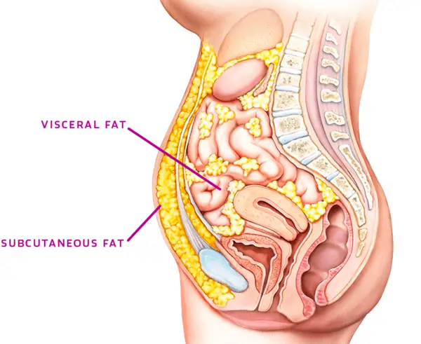 Visceral Fat