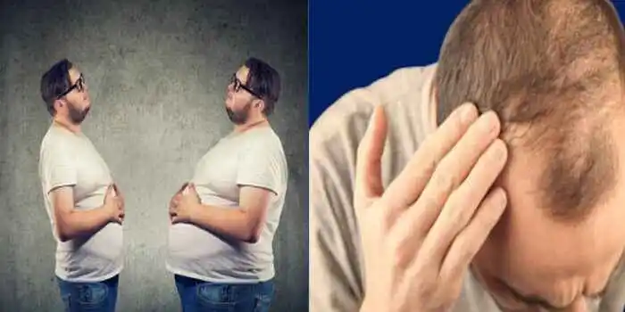 Can-obesity-cause-hair-loss