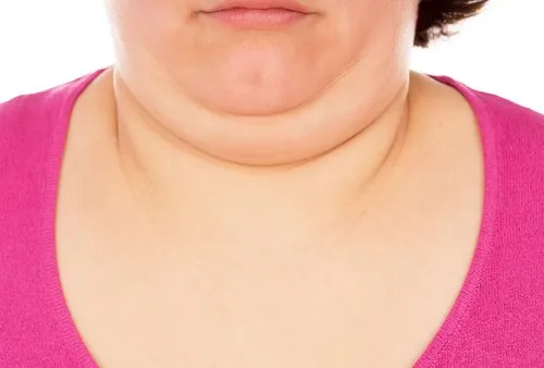 Double-Chin