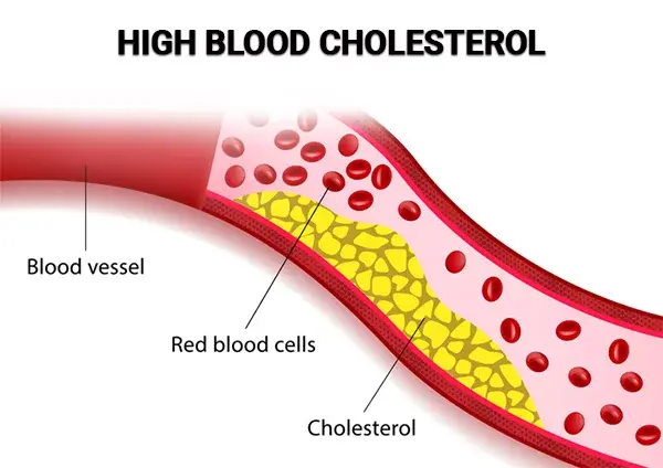 HDL Cholesterol