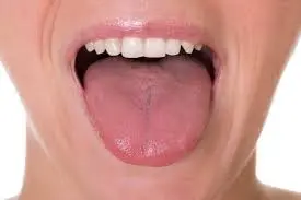 How-To-Loss-Tongue-Fat