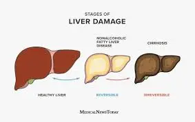 Liver-damage