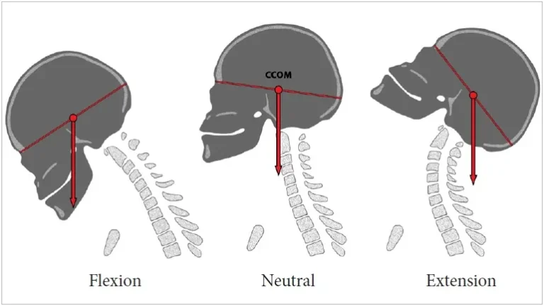 Neck Flexion