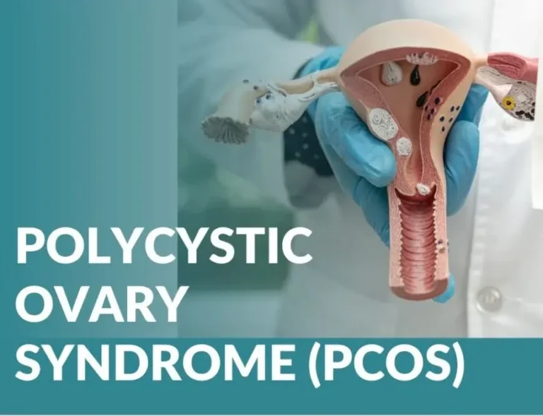 Polycystic Ovarian Syndrome (PCOS)