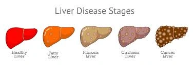 Stages