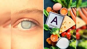 Vitamin A