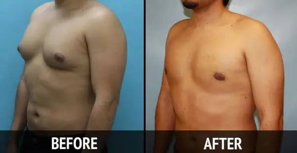 exercises to reduce chest fat