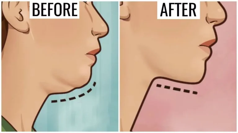 exercises to reduce neck fat