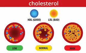 Elevated cholesterol