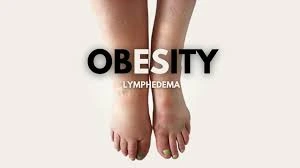 obesity and lymphedema