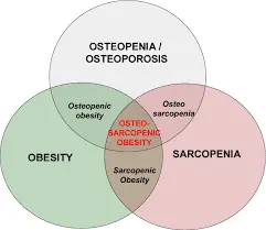 whats relationship between obesity and osteoporosis